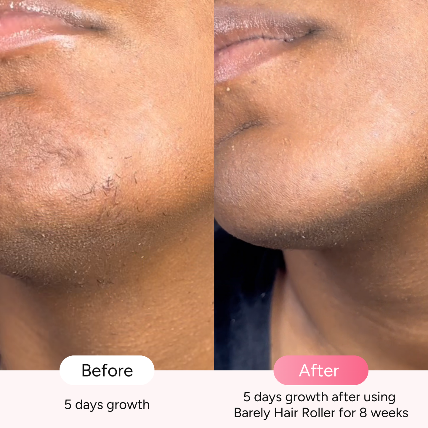 Barely Hair Facial Roller