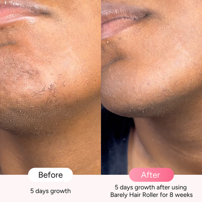 Barely Hair Facial Roller